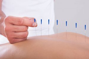 How does Acupuncture Boost the Immune System